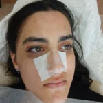 خدمات مراقبت پوستی در رشت | پاکسازی پوست در رشت