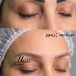 میکروبلیدینگ، رژلب دائم، خط چشم و ریموو در بوشهر